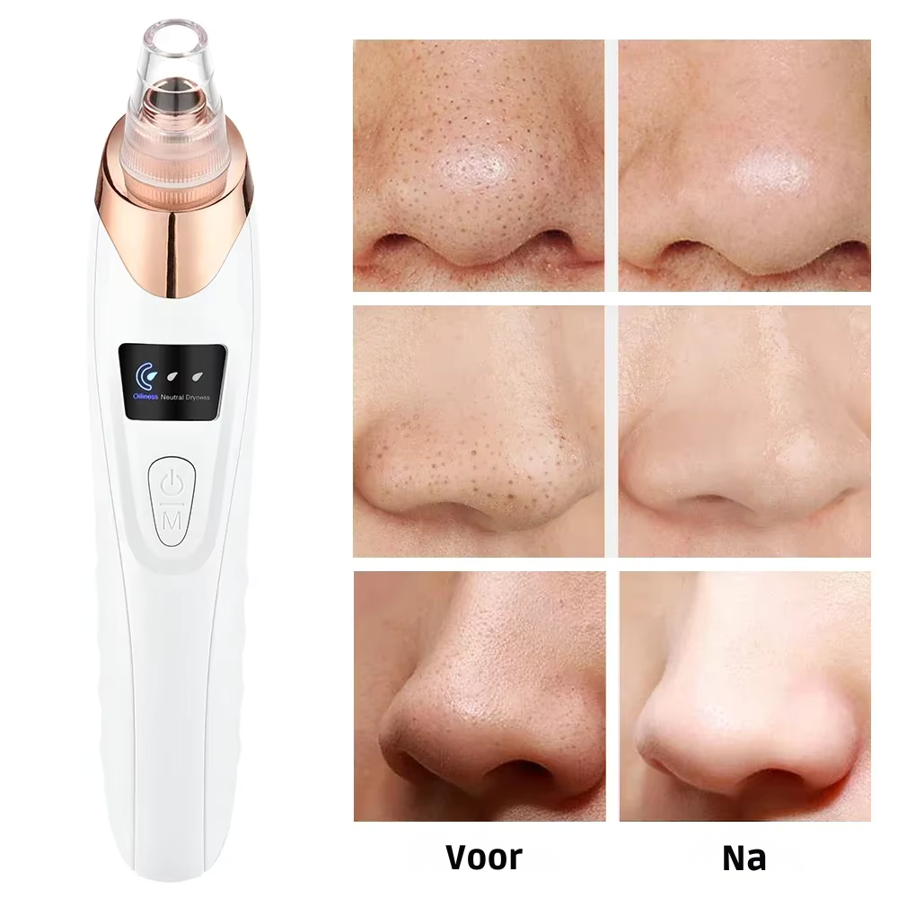 Zavindo ClearSkin Pro