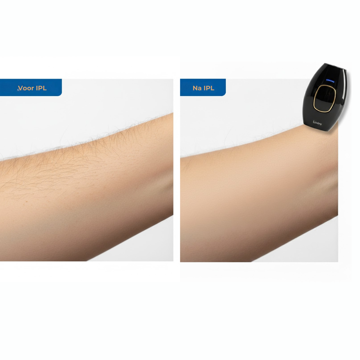 Luvera IPL | De Thuisoplossing voor Langdurige Ontharing (Voor Hem & Haar)